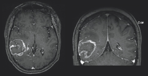 Variations of gray color are surrounded by a both a black and light gray boarder. On the left side of the image, there is a white blob outline.