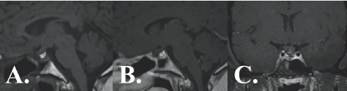 Three images show gray colored variations surrounded by black and white outlining.