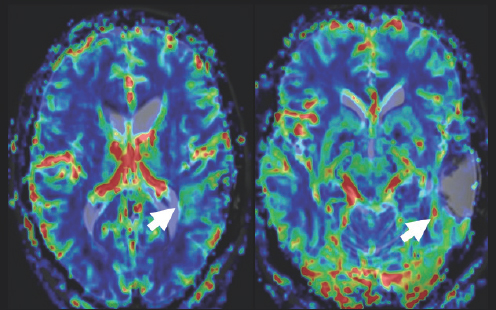 (Left) Dark blue, gray, green, light blue, orange, red, and yellow colors are scattered within a black boarder. A white arrow points to a small light blue blob on the right side of the image. (Right) Dark blue, gray, green, light blue, orange, red, and yellow colors are scattered within a black boarder. A white arrow points to a small red blob on the right side of the image.