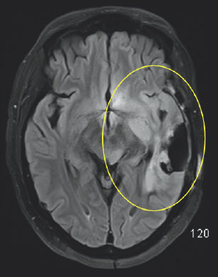 White and light gray color variations are enclosed by a black and dark gray outline. There is significant white coloration on the right side of the image which is highlighted by a yellow oval.